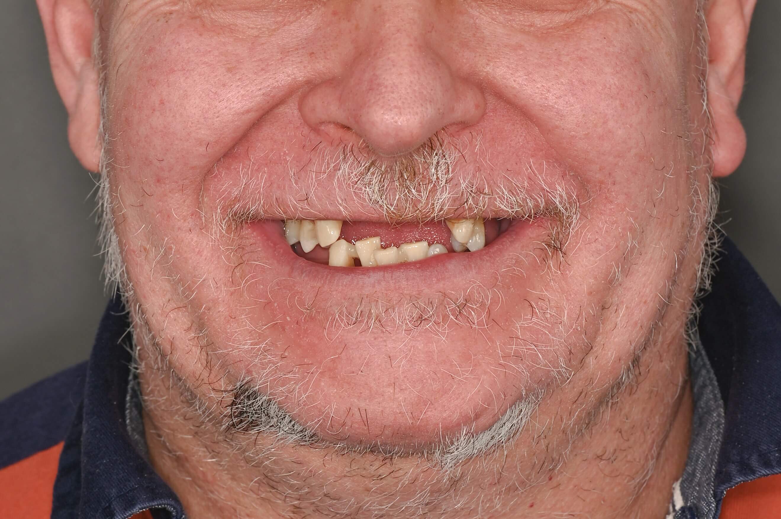 patrahau dragos - inainte